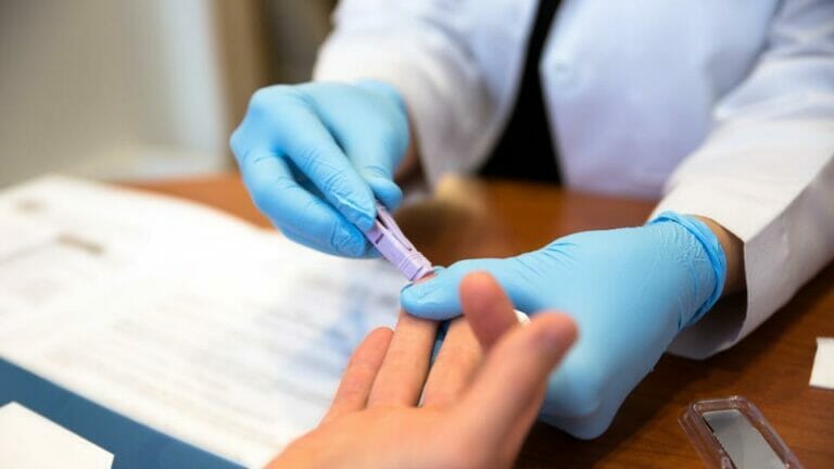 Possibilities For The HIV Positive In The IELTS Test